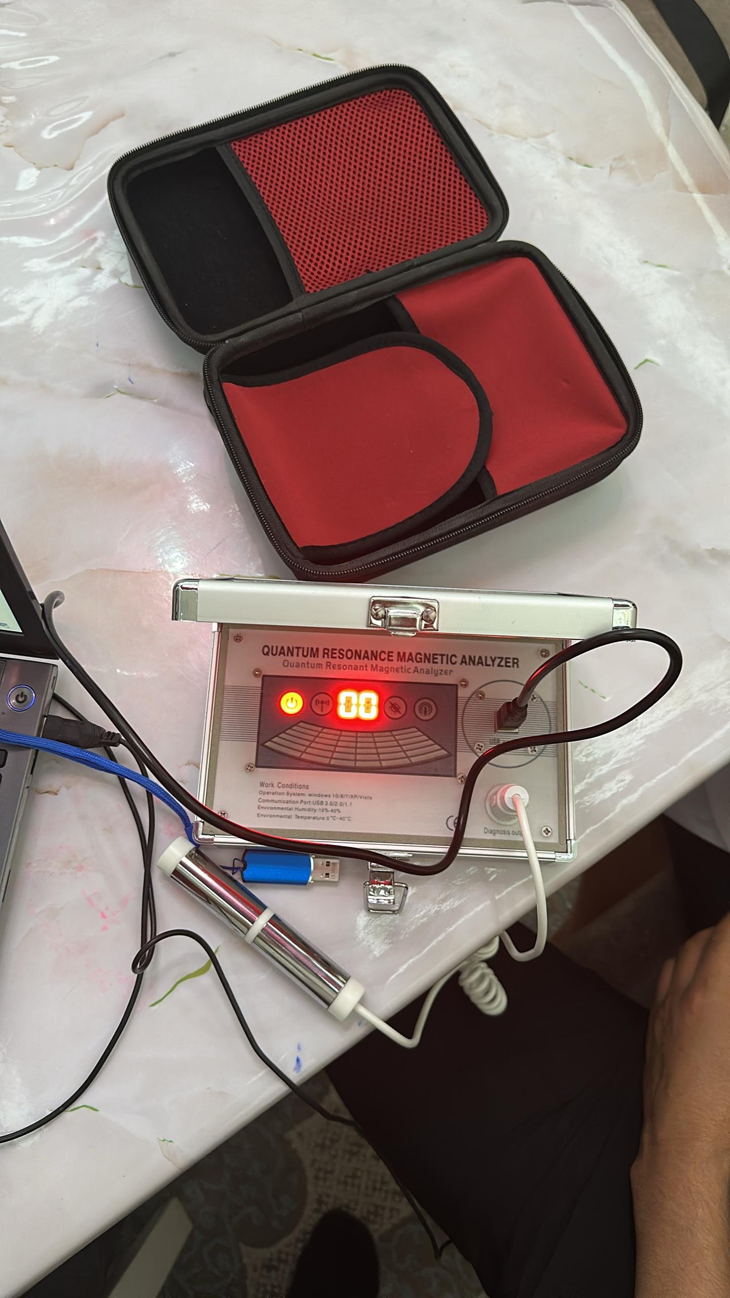 2025-5-4 Кыргызстан Фархат Апсаламов - Скачивание ПО Quantum Analyzer 2 2025 5 4 Kyrgyzstan Farhat Apsalamov Quantum Analyzer Software Download002