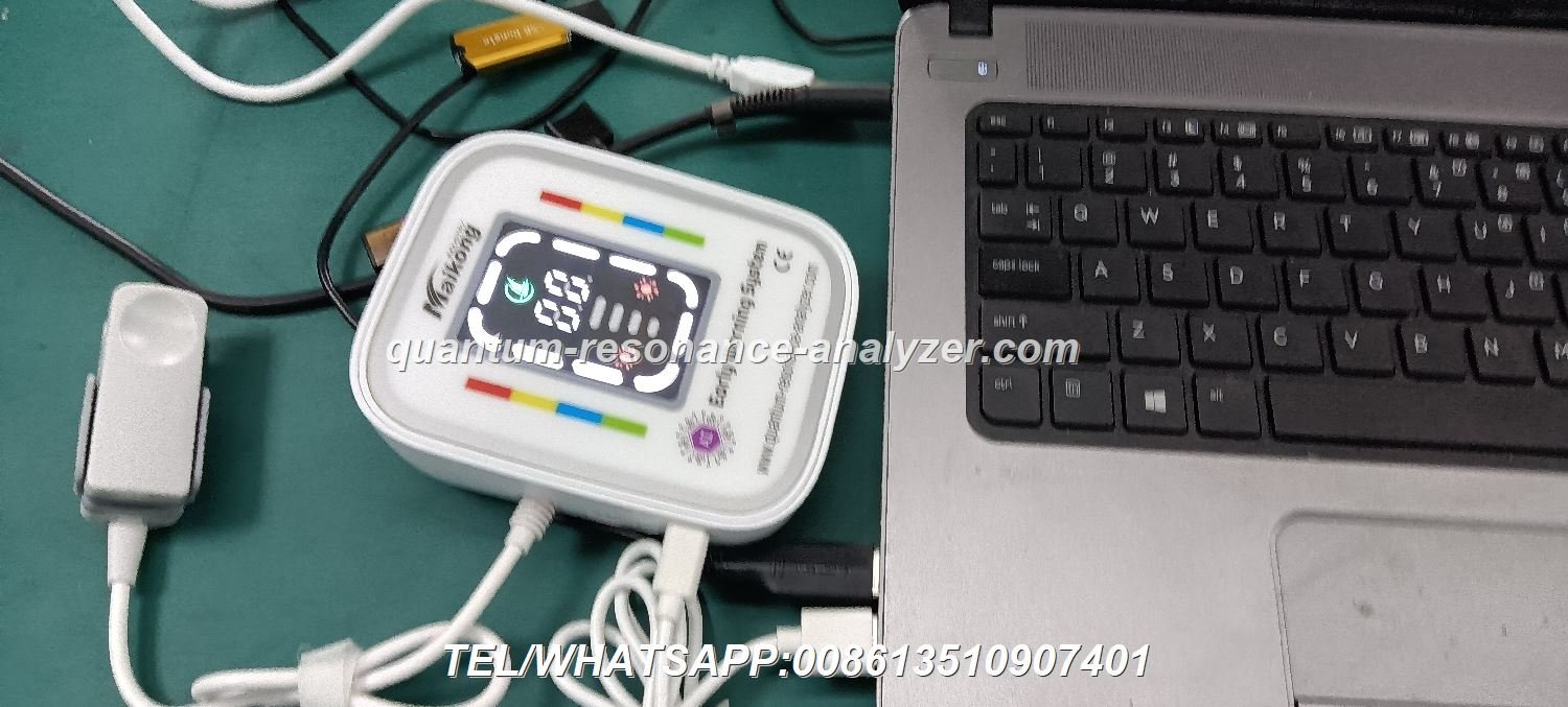 analizador cuántico de resonancia magnética