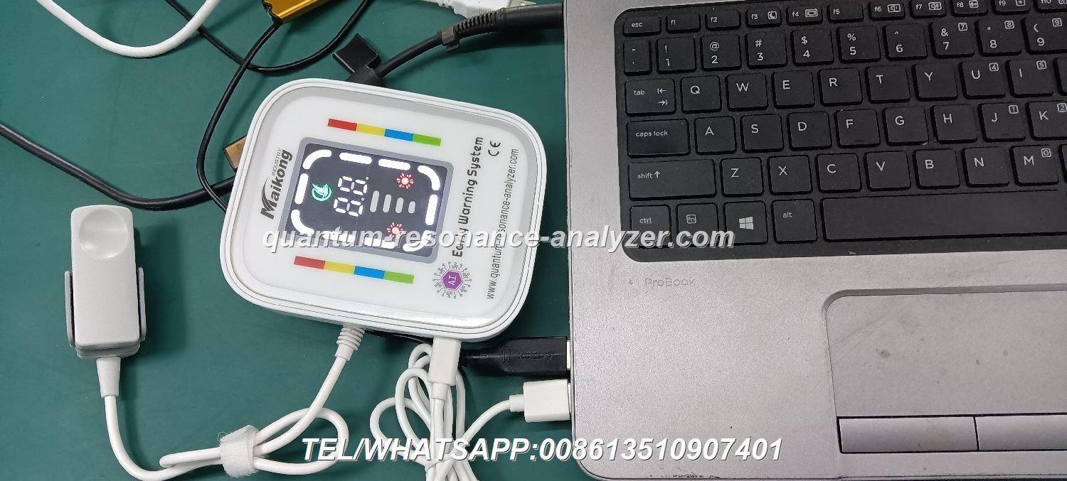 analizador cuántico de resonancia magnética